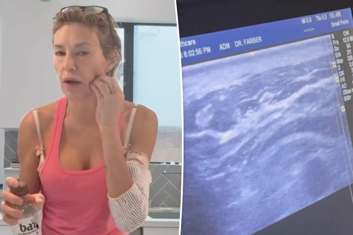 Brandi Glanville's Shocking Ultrasound: What Was Moving in Her Face?
