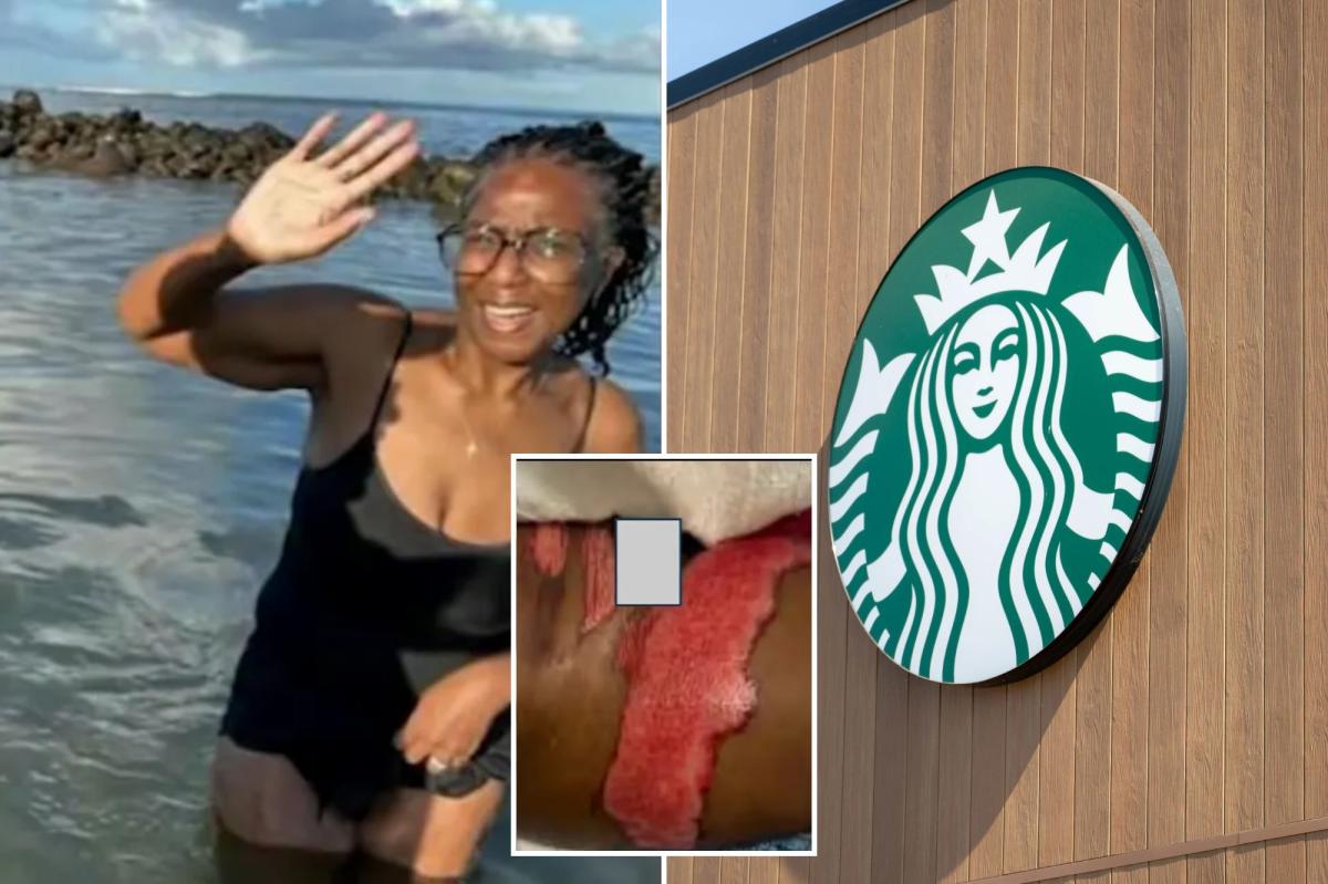 Starbucks Scandal: Boiling Coffee Leads to Shocking Surgery