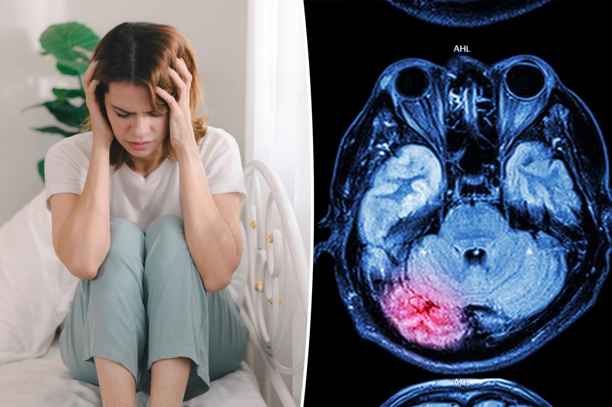 Why Are Young Adults Facing a Surge in Stroke Cases?