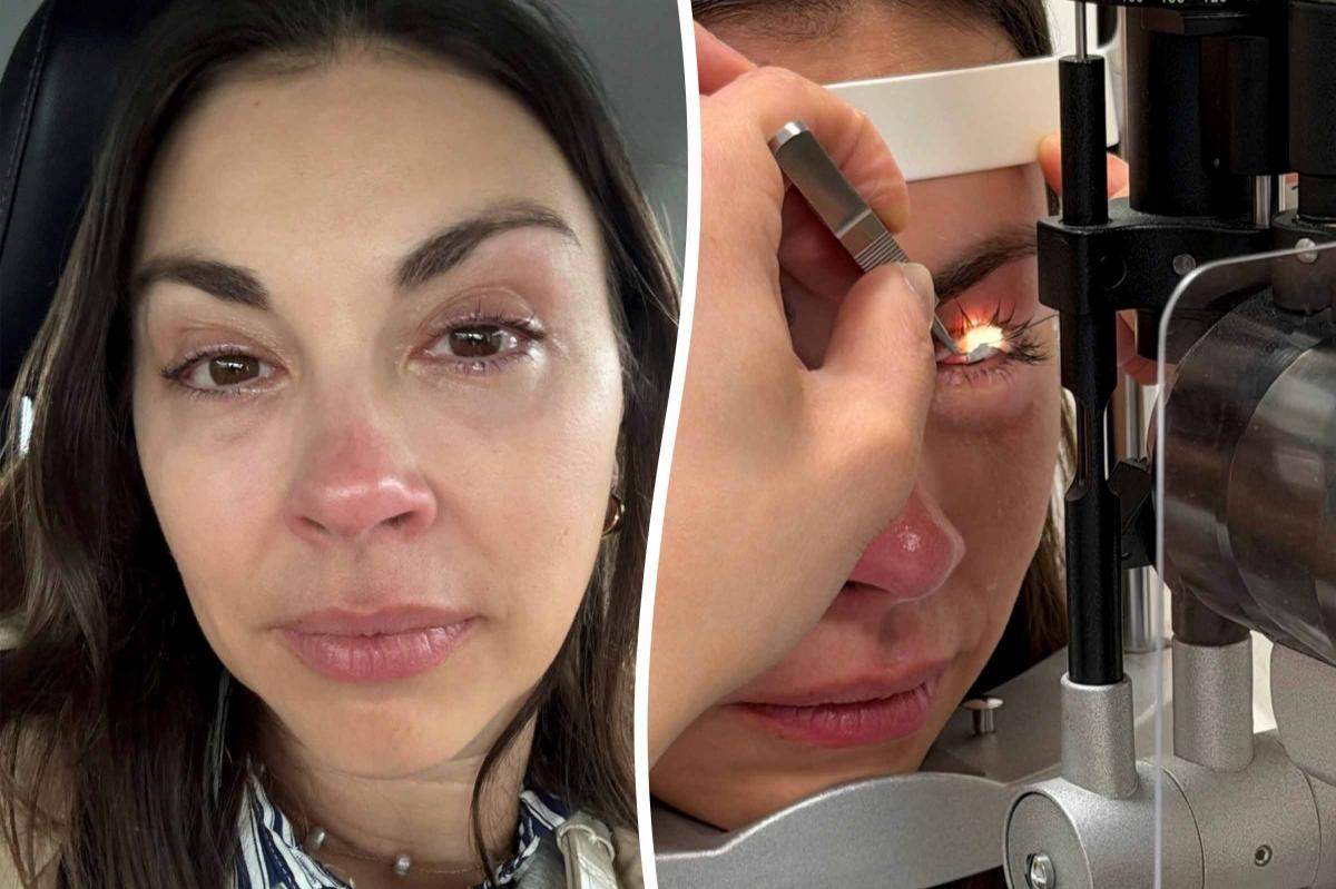 20 Years of Makeup Led to Her Eye Nightmare