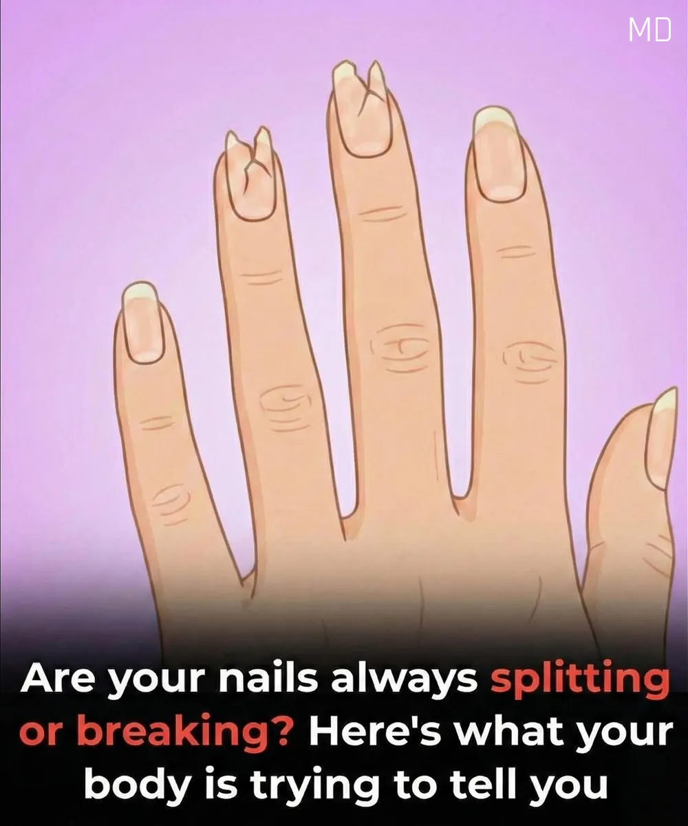 What Your Nails Reveal About Your Health - Uncover the Clues