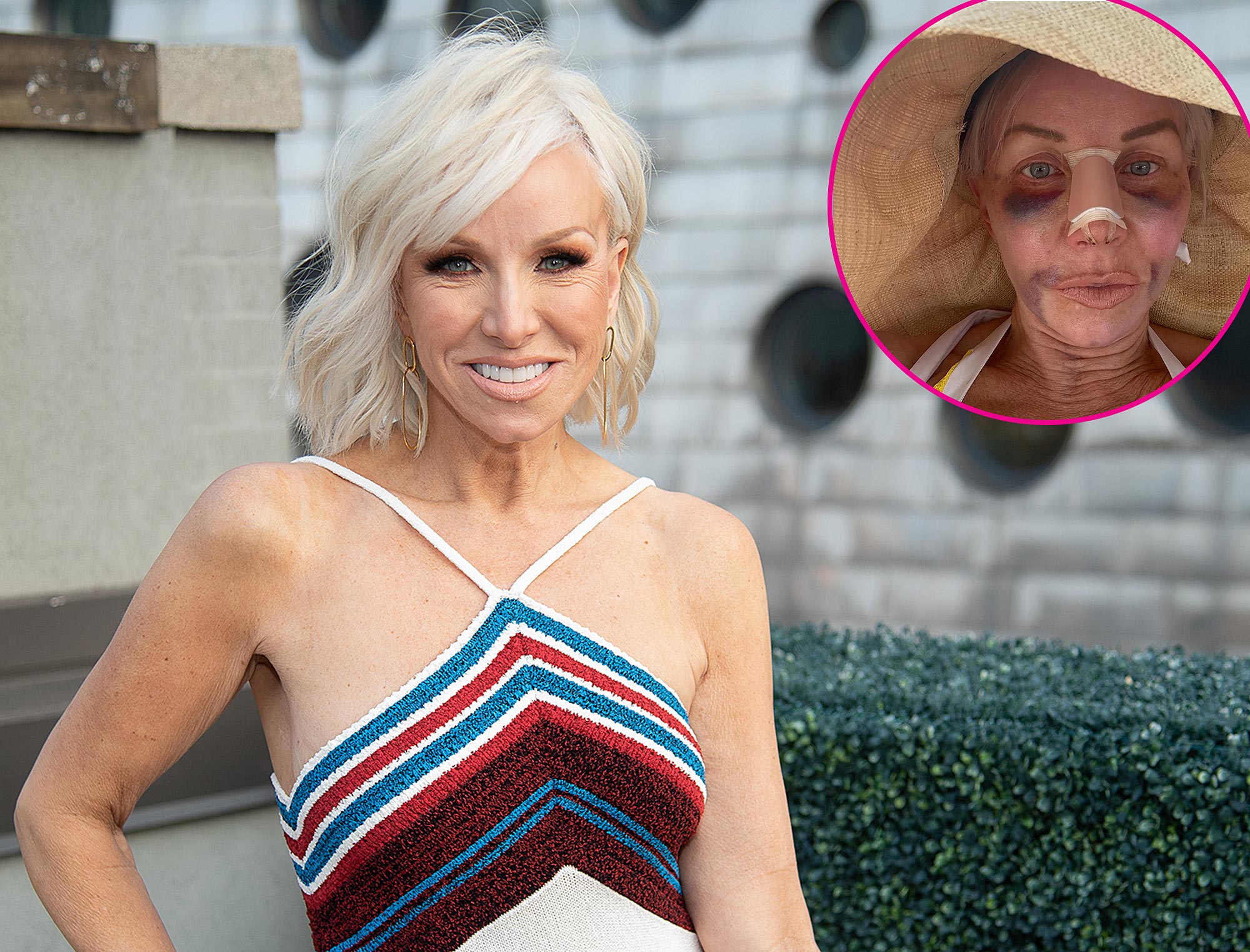 Margaret Josephs Reveals Stunning Transformation Post Nose Job Journey