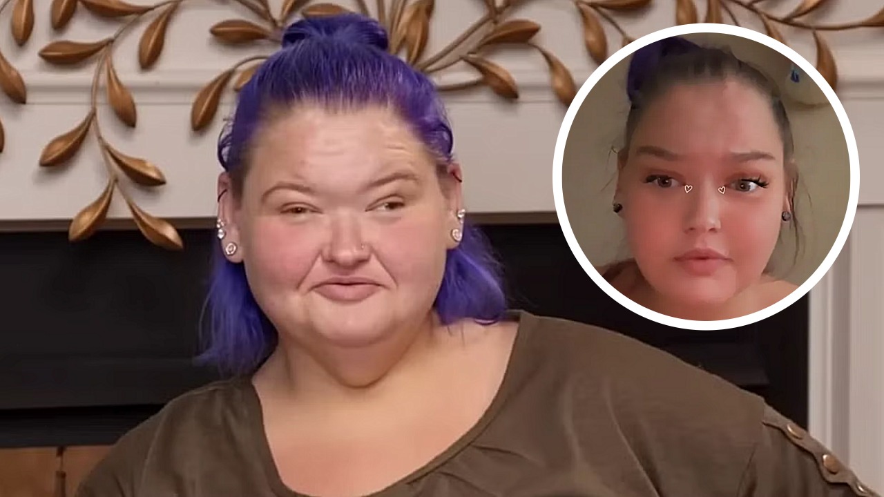 Amy Slaton's Lazy Eye Surgery Outcome Surprises Fans