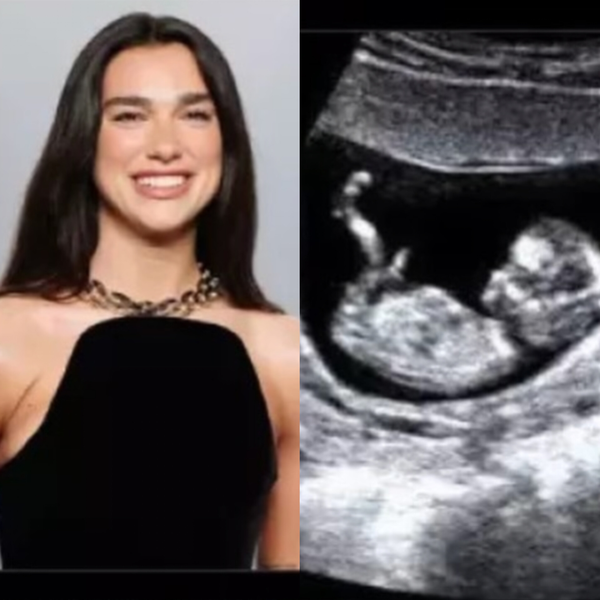 Is Dua Lipa Expecting? The Rumor That's Captured Everyone's Attention