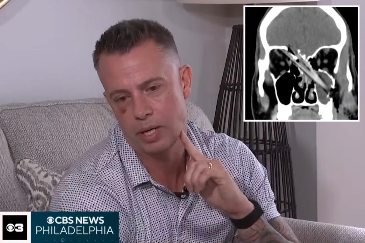 New Jersey Dad's Unbelievable Escape: Tree Branch Pierces Brain Yet He Feels No Pain